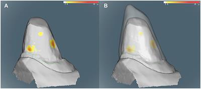 Retrospective Study of 18 Titanium Alloy Crowns Produced by Computer-Aided Design and Manufacturing in Dogs